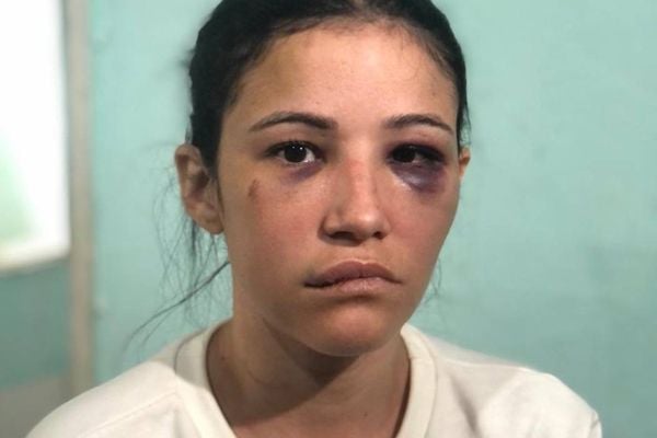 Juliana Aparecida da Silva contou os momentos de terror que viveu nesta quarta-feira (21); o companheiro dela foi preso após agredi-la e ameaçar matá-la e esconder corpo em uma mala