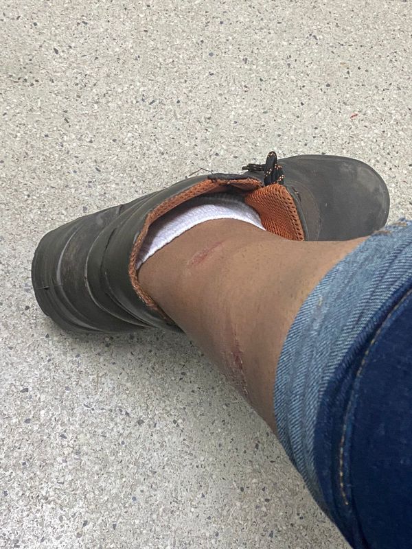 Motociclista sofre acidente e tem pescoço queimado ao ser atingido por fiação no ES por Paulo Vitor Machado