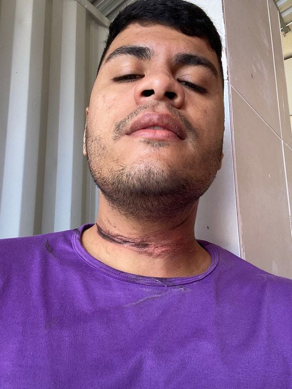 Motociclista sofre acidente e tem pescoço queimado ao ser atingido por fiação no ES por Paulo Vitor Machado