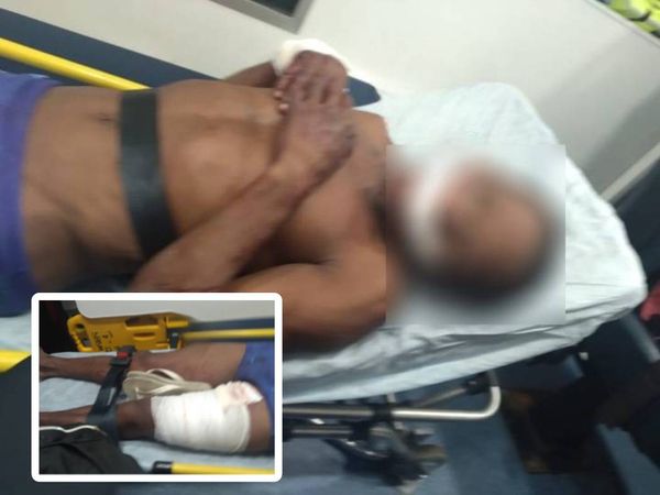 Vendedor de coco ficou ferido após ser mordido por pitbull