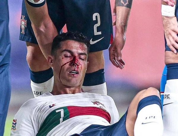 Ronaldo se emociona no Jogo Aberto com a morte de Morsa