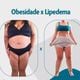 Imagem - Síndrome da gordura dolorosa: o que é a doença confundida com obesidade