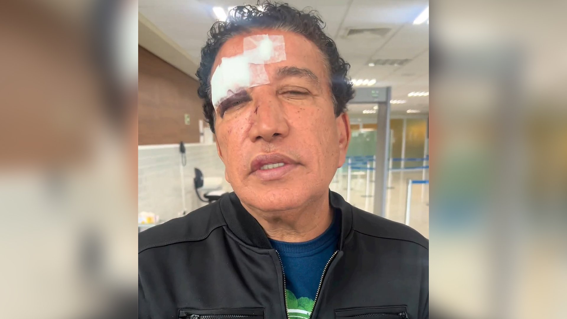 'Sofri um acidente com um blindex no hotel onde estava hospedado', disse o senador em vídeo postado em suas redes sociais