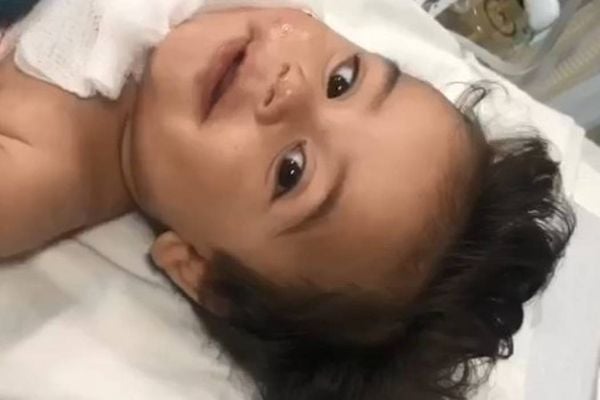 Bebê que teve 40% do corpo queimado no ES aparece em vídeo acenando para a mãe no hospital