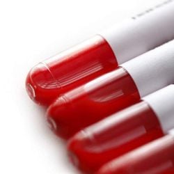 O medicamento chega ao Brasil com preço de tabela a R$ 4.000, com distribuição pela Oncoprod. Mediacamento não está disponível no SUS