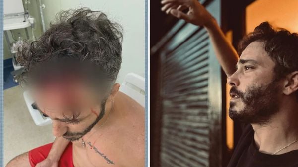 Thiago Rodrigues é assaltado e espancado no Rio