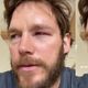 Chris Pratt é picado por abelha e mostra olho inchado em vídeo