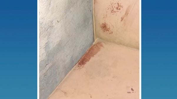 Mancha de sangue também ficou no sofá