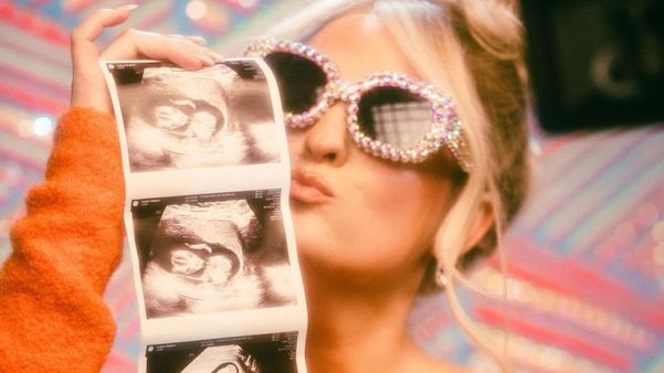 Artista publicou uma imagem do exame de ultrassonografia do bebê; o casal já tem um filho de quase dois anos