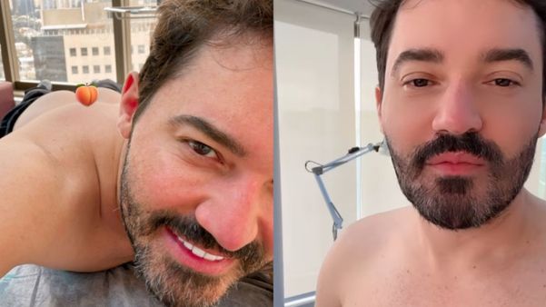 Fernando Zor fez procedimento no bumbum