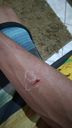Homem é atacado por cachorro rottweiler em Piúma(Mike Klimaschevski)
