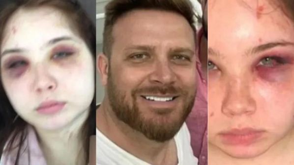 Kauane Cellarius, de 22 anos, denunciou o pai e cantor Fernando Cellarius, da dupla Giba & Nando; ela afirma que é alvo de agressões físicas desde criança