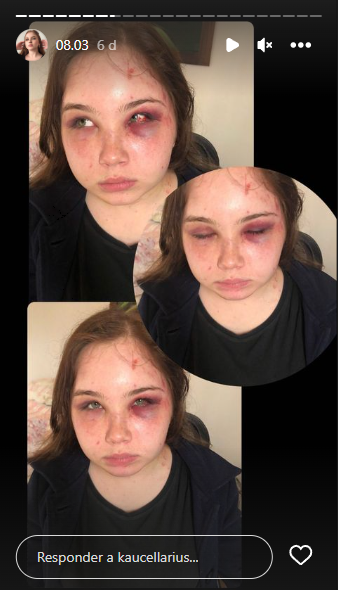 Kauane Cellarius usou o Instagram para mostrar as agressões sofridas por parte do pai