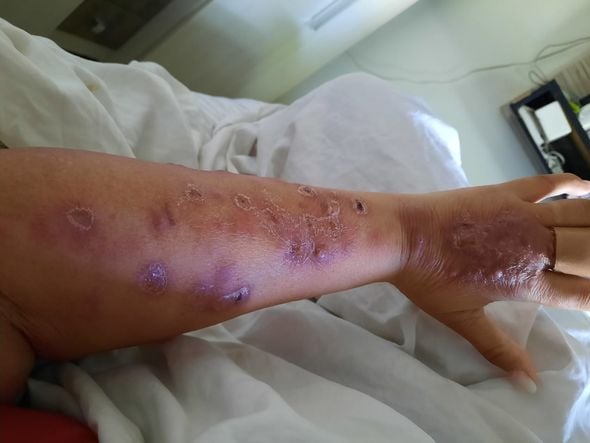 Esporotricose: casos de doença sobem em Linhares por Divulgação/Prefeitura de Linhares