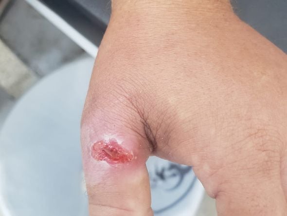 Esporotricose: casos de doença sobem em Linhares por Divulgação/Prefeitura de Linhares