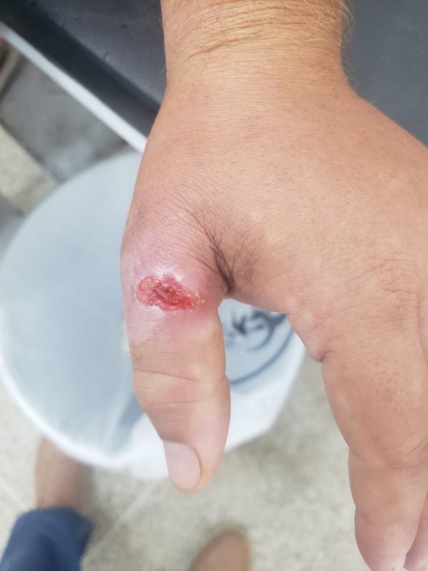 Esporotricose: casos de doença sobem em Linhares por Divulgação/Prefeitura de Linhares