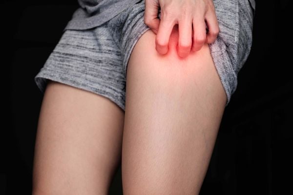  Irritações causadas pelo excesso de atrito