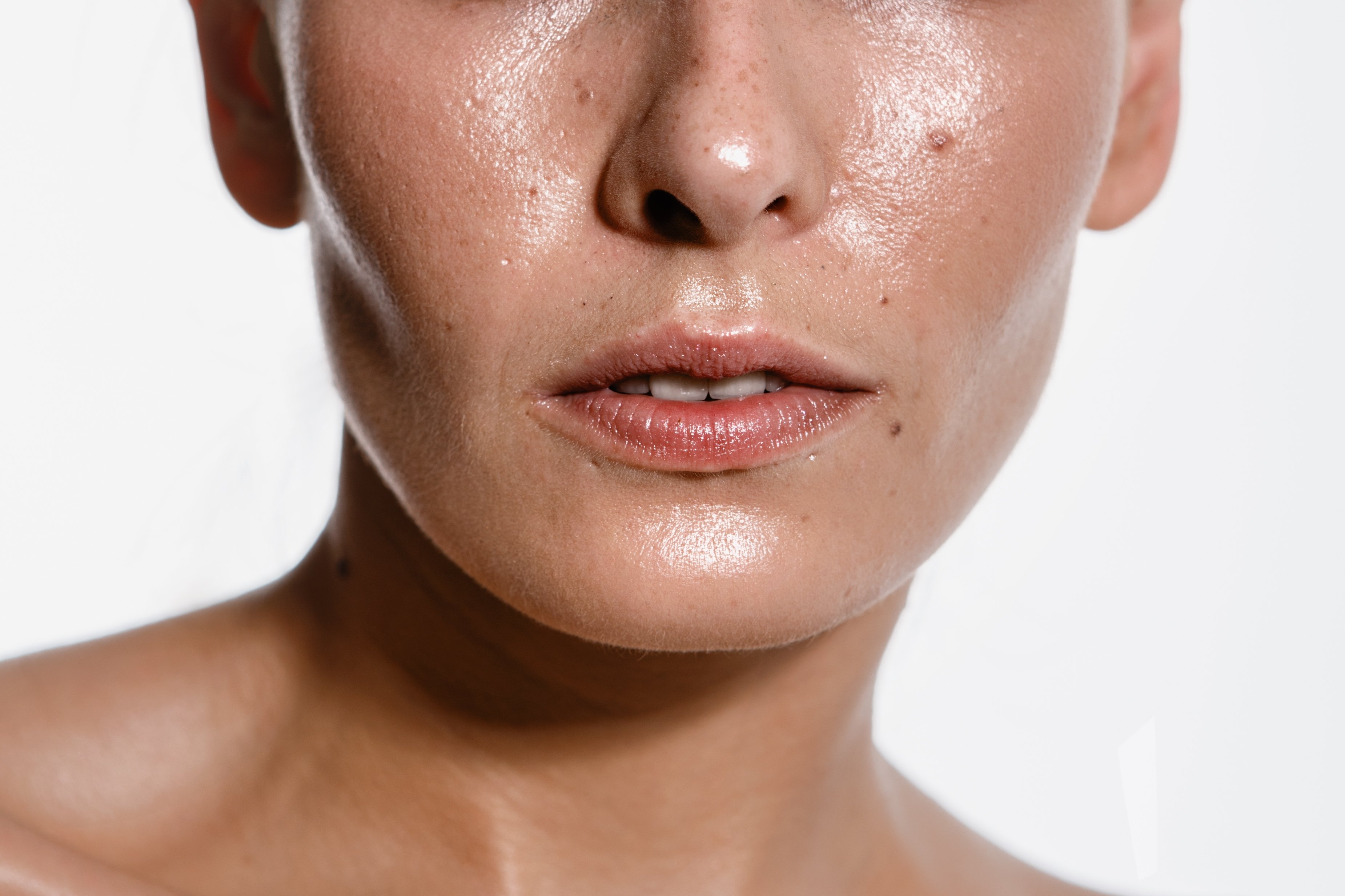 Caracterizada pelo excesso de brilho em razão da oleosidade e dos poros dilatados, a pele oleosa tem uma maior tendência à acne