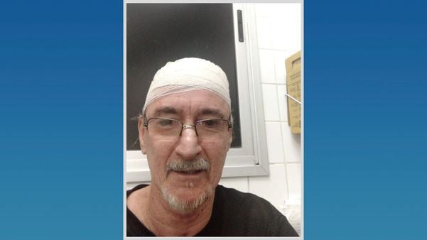 Professor agredido a pauladas em Vila Velha