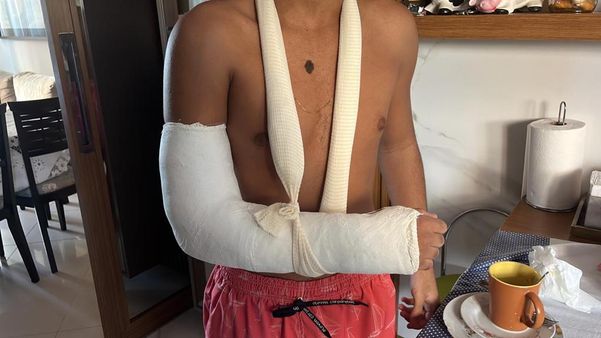 Adolescente quebra o punho após levar choque em corrimão da Ilha do Frade