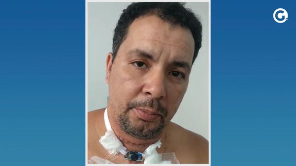 José Cordeiro foi ferido por linha de pipa no dia 4 e passou alguns dias na UTI