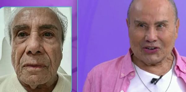 Stênio Garcia antes e depois da harmonização facial