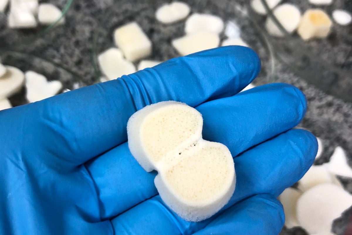 Biomaterial desenvolvido por pesquisadores, que pode ser usado em implantes dentários ou fraturas maiores, torna enxertos ósseos mais acessíveis para a população por substituir material importado