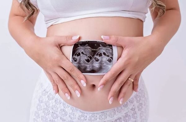 Quezia com a primeira ultrassom em que descobriu que estava grávida de sêxtuplos