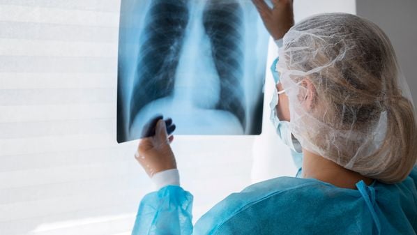 CBN Vitória - 4n3kdlfn