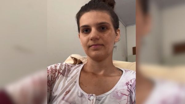 Larissa está na casa de uma amiga enquanto ainda precisa fazer curativos no hospital da Serra