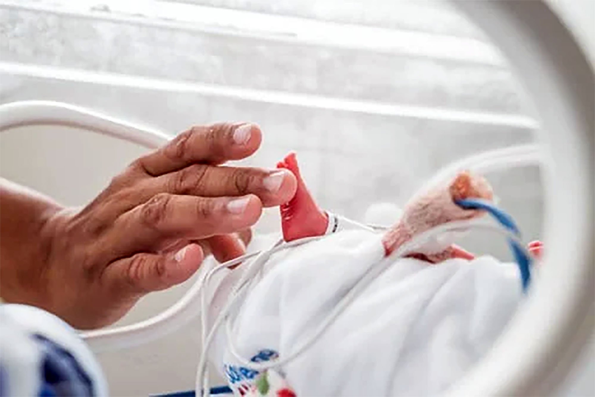 Segundo o pai do bebê, a transferência foi feita para fecharem uma válvula no coração do filho; família pede doação de qualquer tipo sanguíneo