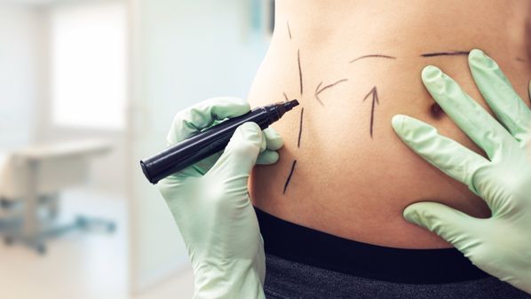 O cirurgião plástico Ariosto Santos explica como escolher o médico para fazer a cirurgia dos sonhos, quais as principais tendências da especialidade e as tecnologias que chegaram para trazer resultados ainda mais satisfatórios
