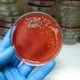 Colônia de Streptococcus em laboratório