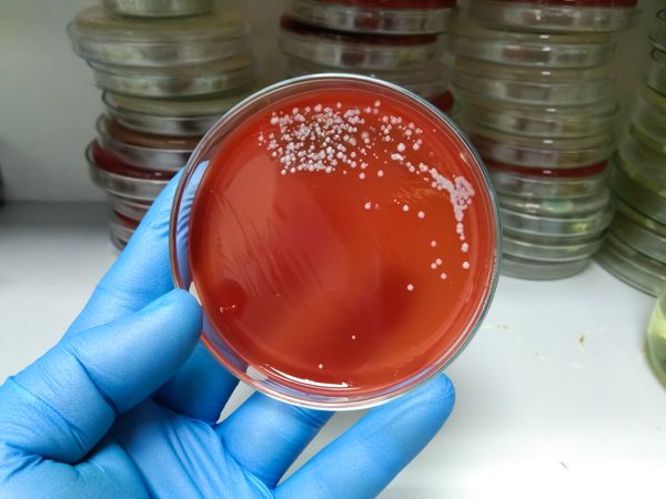 Colônia de Streptococcus em laboratório