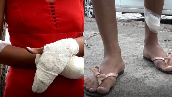 mulher é agredida pelo esposo com fação, chutes e socos em Vila Velha