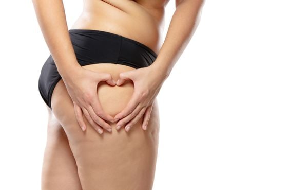 Como é a Lipoaspiração de Lipedema, by Lipedema Journal