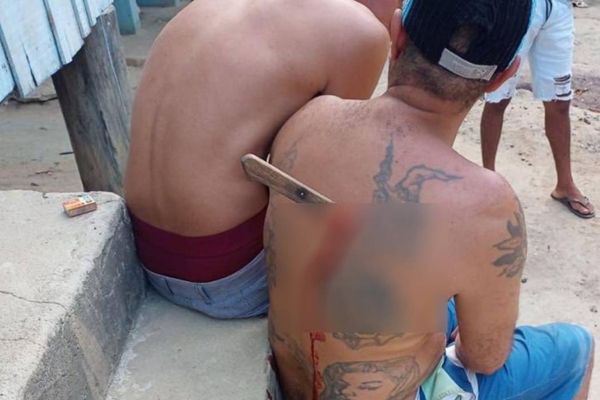 Homem esfaqueado conseguiu ficar sentado após sofrer agressão, em Vila Valério