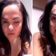 Imagem - Dermatologistas explicam os riscos e cuidados antes de fazer o botox