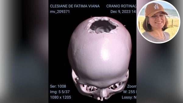 Clesiane de Fátima Viana realizou tomografia da cabeça no último sábado (11); segundo marido dela, quadro de saúde da empresária é estável