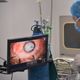 Imagem - Riscos e resultados: especialista tira dúvidas sobre cirurgia de catarata