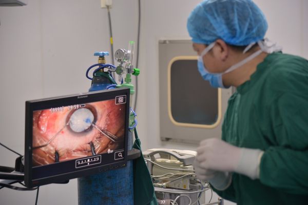 A cirurgia da catarata consiste na remoção da lente natural do olho