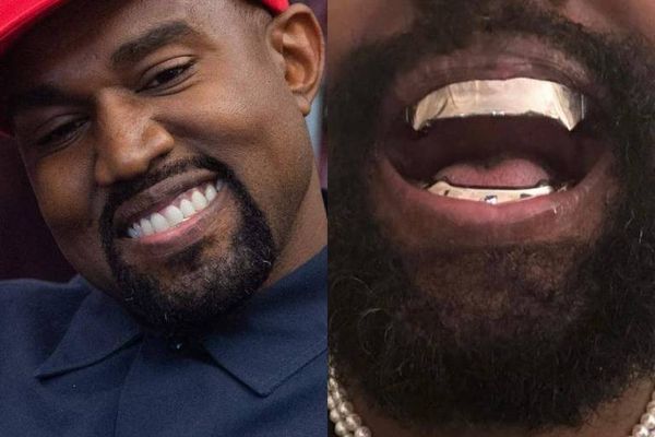 Kanye West mostra novo sorriso nas redes sociais 