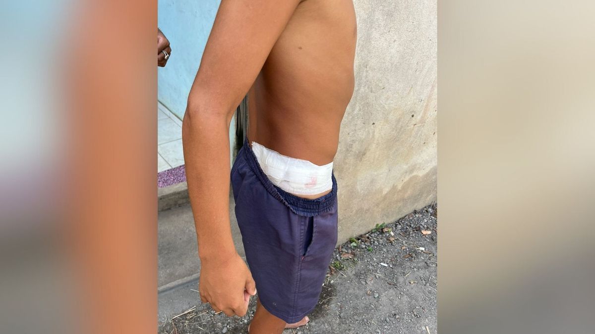Adolescente vítima de bala perdida em Vila Velha mostra ferimentos