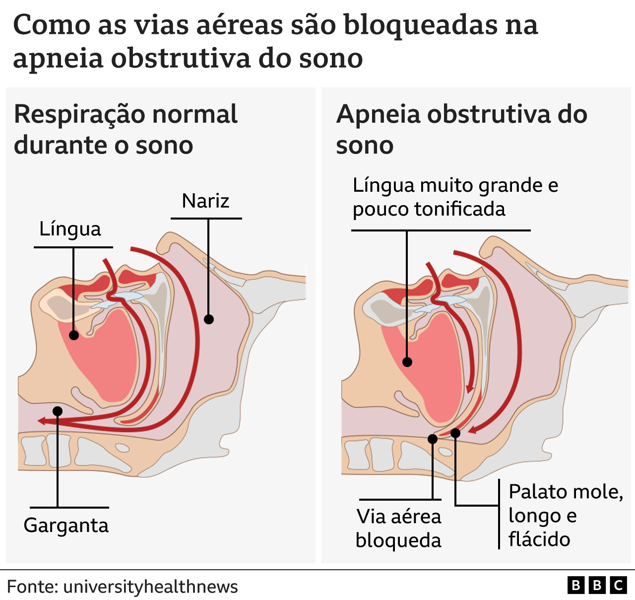 Imagem BBC Brasil