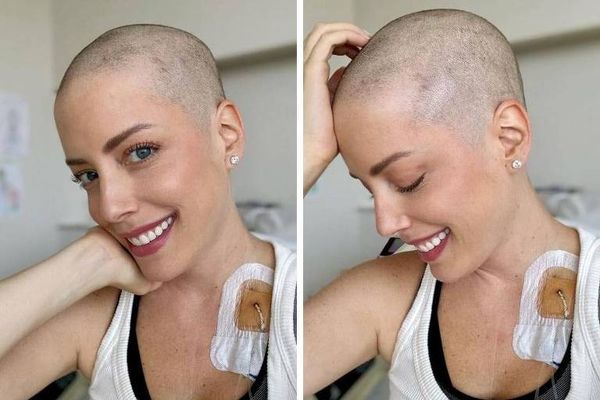 Fabiana Justus raspa cabeça durante tratamento de leucemia
