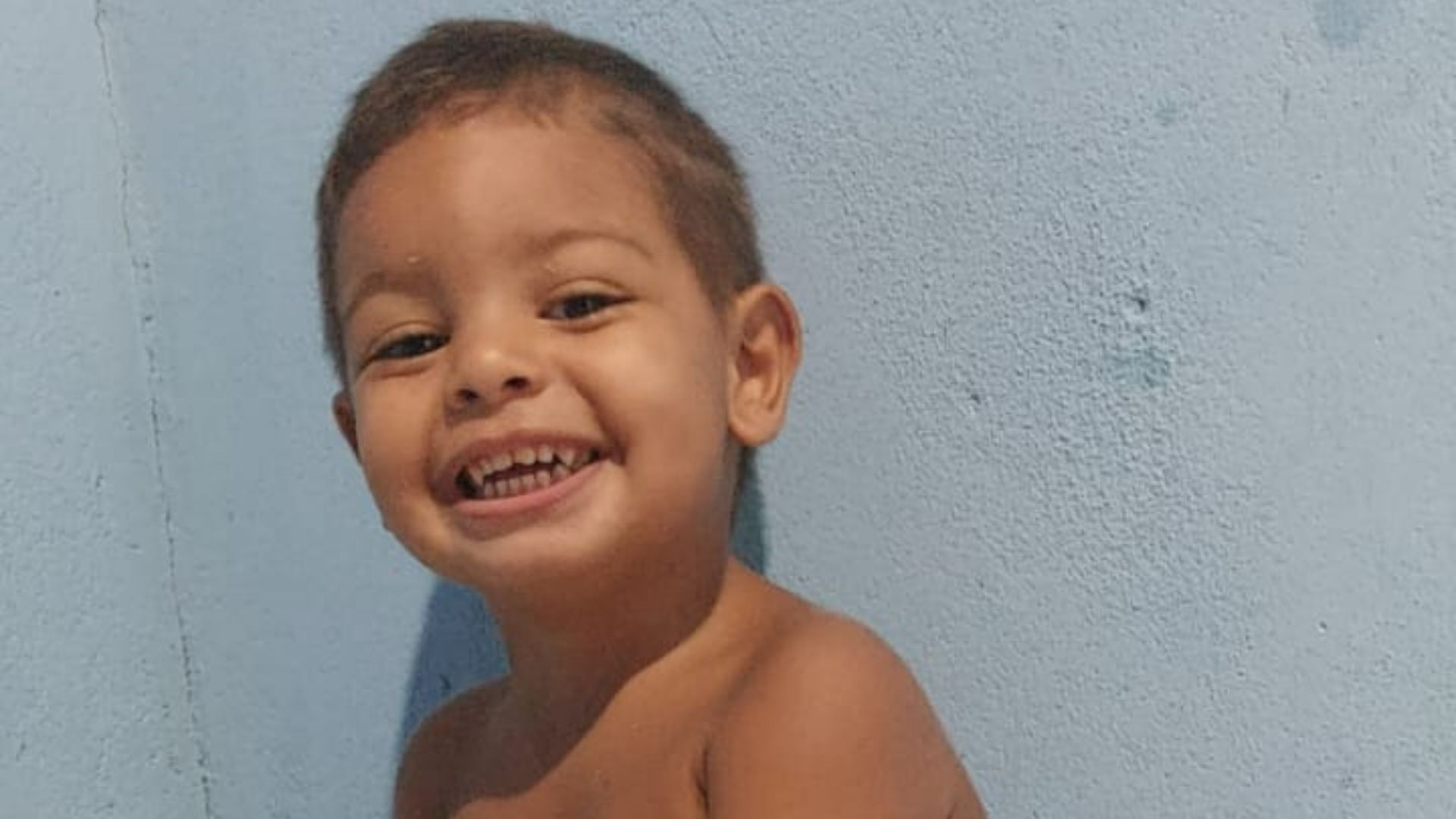 Mãe de Henrique Guimarães contou que filho teve 60% do corpo queimado após uma panela com água quente cair sobre a criança