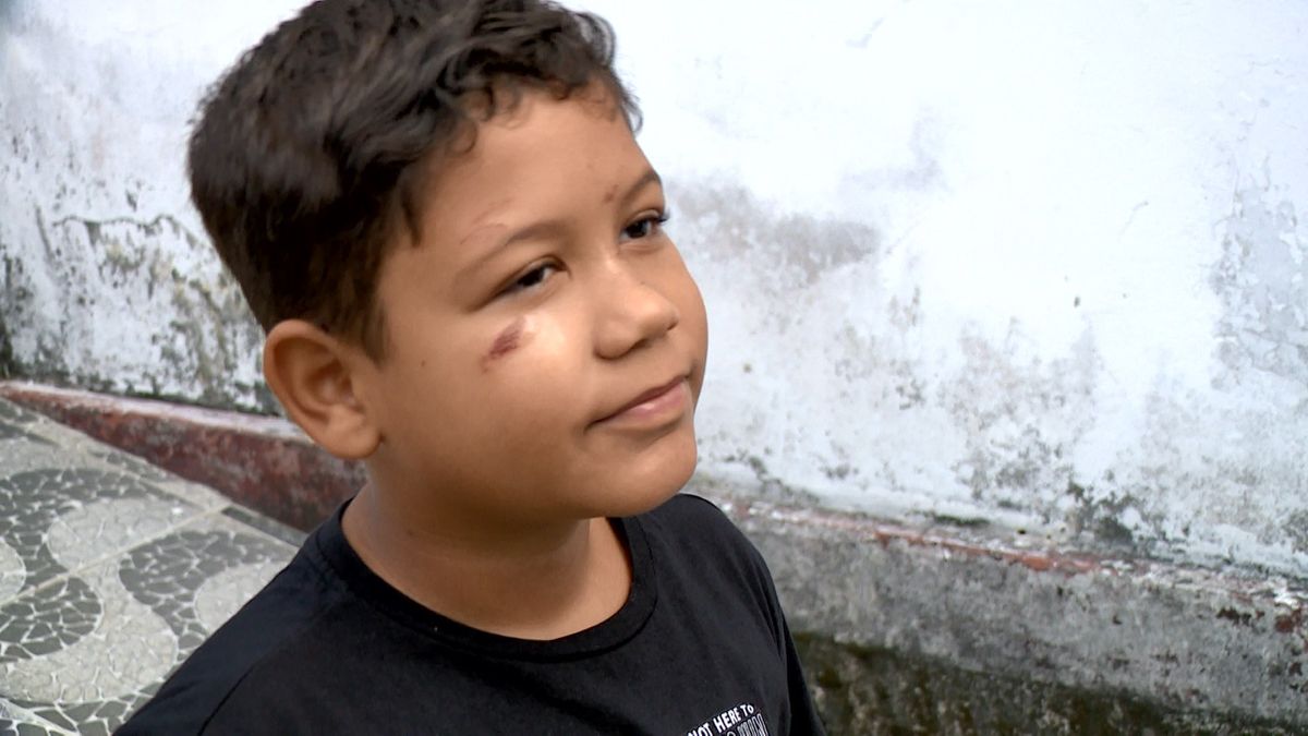 Menino de 9 anos fica ferido após ser atacado por boi em São Mateus