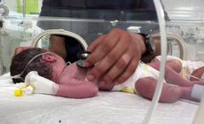 A bebê de Gaza retirada viva do ventre da mãe morta após ataque de Israel