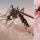 Imagem - ES registra aumento de casos de arboviroses como dengue e oropouche