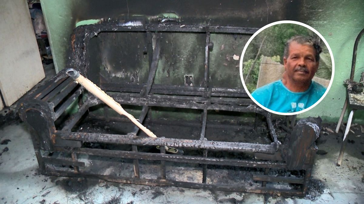José de Abreu, de 56 anos, teve 90% do corpo queimado após ataque criminoso dentro de casa